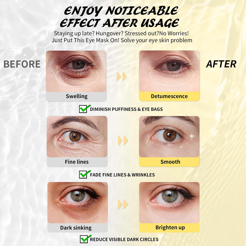 Maskiss Under Eye Patches (30 Pairs), Caffeine Eye Masks for Dark Circles Puffy Eyes Undereye Bags, Collagen Eye Patches for Wrinkles and Puffiness, Skin Care Gift for Her image 4