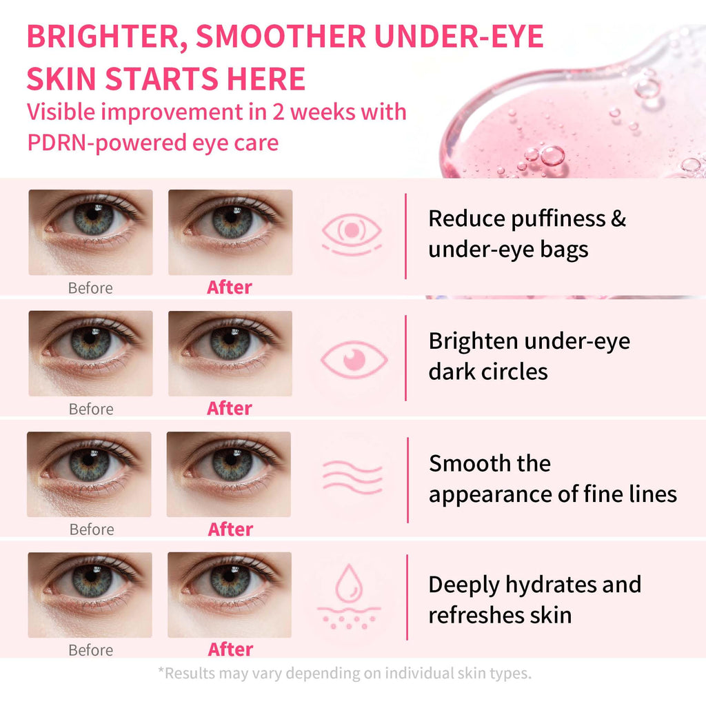 Maskiss PDRN Under Eye Patches (25 Pairs), Pink Eye Gel Pads with Caffeine Collagen Peptides, Eye Masks for Dark Circles Puffiness Fine Lines, Hydrating Soothing Self Care Gifts for Women image 5